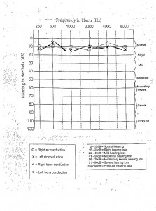 audiogram pic2